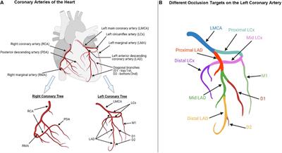 Current Status and Limitations of Myocardial Infarction Large Animal Models in Cardiovascular Translational Research